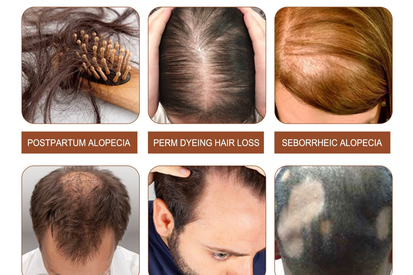 Revitalizing Batana Oil Hair Treatment Collection